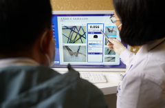 青岛兴尚植发:发际线